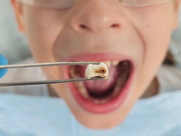Best Emergency TMJ Treatment in Minneapolis, KS